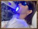 ムーンホワイトニング(Moonホワイトニング)の写真/【メンテナンス】他店で効果があってもなくても、白さを維持する秘訣