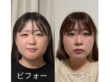 ハンドフィット(Handfit)の雰囲気（目元パッチリ！むくみが取れてお顔のパーツがハッキリしました♪）
