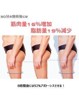 オリエンタルローザ 表参道(Oriental Rosa)/電磁パルス痩身機で脂肪19％減！