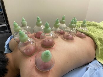 あかし整体院/吸い玉ご案内