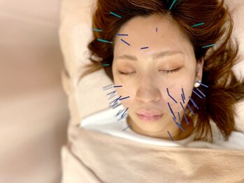 こじま 富雄団地接骨院/美容鍼