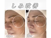 サロンデュ ひゃーく(Salon du ひゃーく)/～悩みのないツヤ肌美人への道～