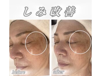 サロンデュ ひゃーく(Salon du ひゃーく)/～悩みのないツヤ肌美人への道～