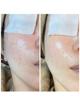 アトレ(Atre)/ゾンビエステ★