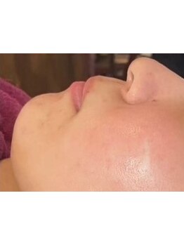 お肌をきれいにしたい