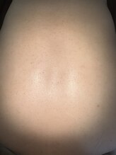 ミニョン(mignon)/毛穴がキュッ！