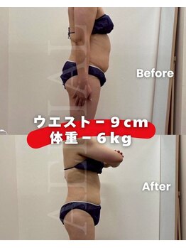 エアリアル 武雄店/2ヶ月経過でマイナス6キロ