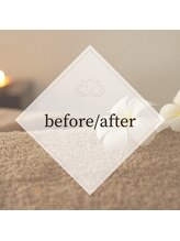 えにし整体 鍼灸整骨院/before/after