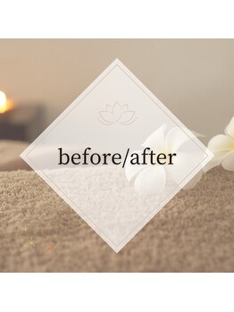 えにし整体 鍼灸整骨院/before/after