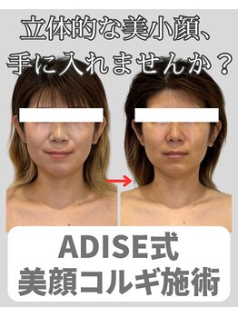 アディス 心斎橋(ADISE)/ADISE式コルギで立体的美小顔！