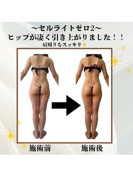 ナチュールファースト(naturel first)/