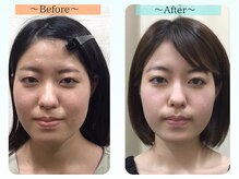 シンメトリー ルミネ新宿店の雰囲気(頬の幅/フェイスライン/歪み/エラ/肌のたるみケア/目の大きさ)
