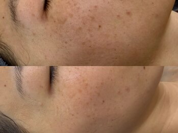 ビーズアモール 大府店(B's amor)/B’s amor 大府店 facial