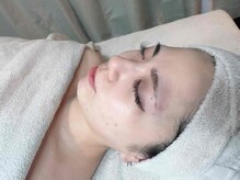 ヴィズクラブ バイ ビネル(Vi's CLUB by BINEL)/ハーブピーリング