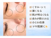 まつげ屋リュ( Ly)/ララピーリング