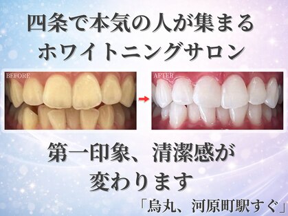 ホワイトニングショップ 四条店の写真