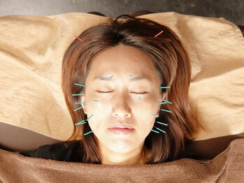 エルドラード(EL DORADO)の写真/美容鍼・鍼灸+ボディケア　様々なお悩みご希望にお応えします！肌質改善・肩こり・腰痛・頭痛・慢性疲労等