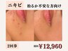 【じっくり効果を見たい方】変化を見て今後を決めたい方向け2回券￥12,980
