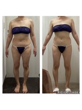 リオンズ 茨城ミスターマックス取手店/お腹・脚すっきり！【痩身】