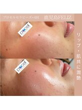 フェリス(FELIZ)/お肌プロセルセラピーズ