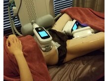 ユー(U)/脂肪冷却　３CUP　お腹・内もも
