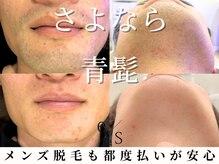 エス(es)の雰囲気（メンズ脱毛人気です◎効果実感のお声多数/部分脱毛もお気軽に♪）