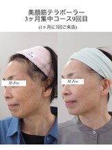 エクレクティック(ECLECTIC)/テラボーラー/フェイシャル