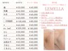 ルメラ【脇】黒ずみ・くすみ除去 モニターキャンペーン中