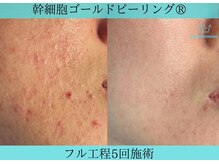 リメイククリニカルビューティー(Remake clinical beauty)/