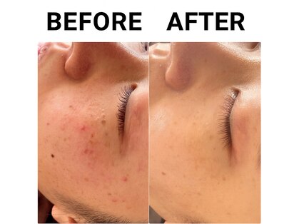 ベルファム(Belle femme)の写真