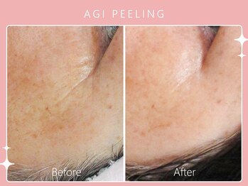 シロカネ 光の森店(SHIROKANE)/アギピーリング☆