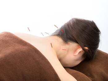 こいわ鍼灸院ハリコア(HARICORE)の写真/頑張りすぎた心身に巡りのご褒美♪自律神経の乱れや重い疲れを、オーダーメイドの鍼灸で優しく整えます◎