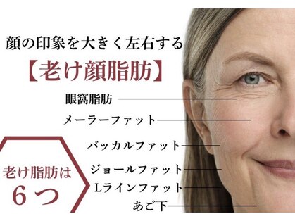 ミヤビ(MIYABI)の写真