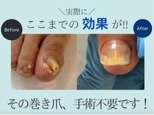 エターナル巻き爪金沢の雰囲気（巻爪・陥入爪・陥入爪・変形爪などお任せ下さい。）