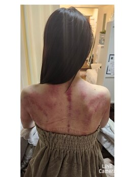 セレブリティ(Celebrity)/施術