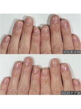 ギフト(GIFT)/自爪育成ネイルケア