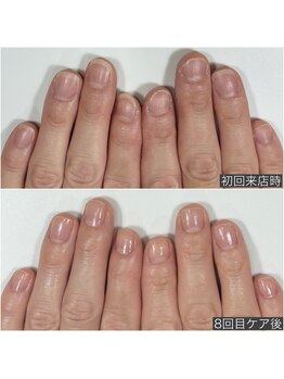 自爪育成ネイルケア