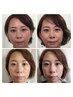 【いつも笑っている素敵な小顔整体】笑顔の小顔コース 40分◆一段と素敵に♪