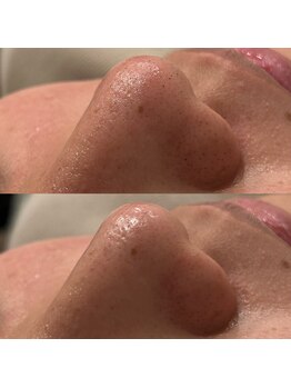 クラウン 心斎橋店(CROWN)/アイブロウ/眉毛/まゆげ/眉