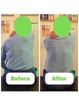 ナオル整体 長崎大村院(NAORU整体)/７0代男性施術事例【猫背矯正】