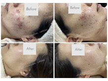 コトン(cotton)の雰囲気(肌結果を追求★★トラブルをくり返さない美肌へ)