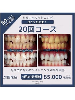 ホワイトニングショップ 豊田店(WHITENING SHOP)/20回コース!