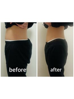 サイズダウンを目指したい