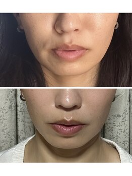 エフ(f)/1日1回のリセットで肌引き締まる