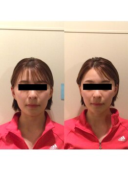 美骨ラボ 自由が丘(美骨Labo)/施術before&after