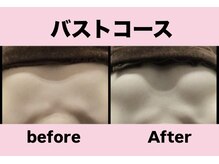 エステティック　レイビス 渋谷店(RAYVIS)/ボリュームアップバスト！