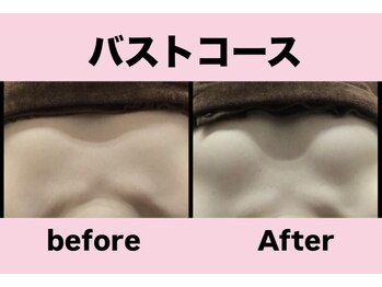 エステティック　レイビス 渋谷店(RAYVIS)/ボリュームアップバスト！