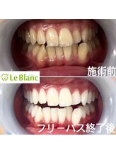 ルブラン 奈良店(Le Blanc)/興味わきませんか？