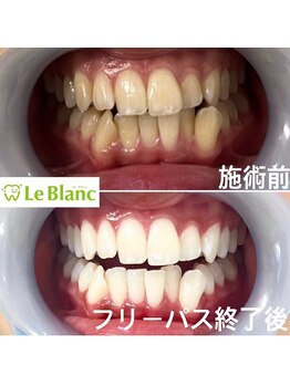 ルブラン 奈良店(Le Blanc)/興味わきませんか？