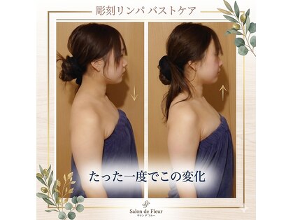 リベラ(LIBERA)の写真